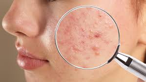 Dermatologie